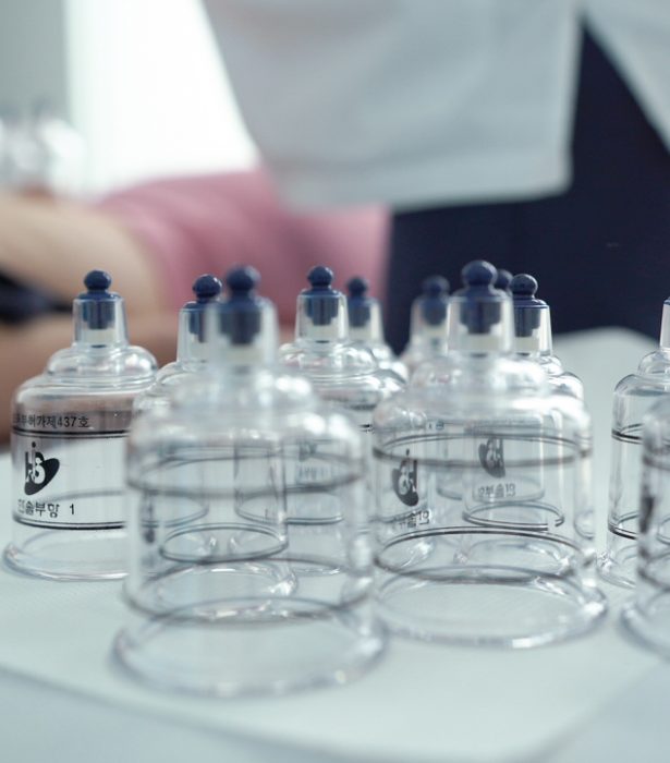 Cupping Therapy